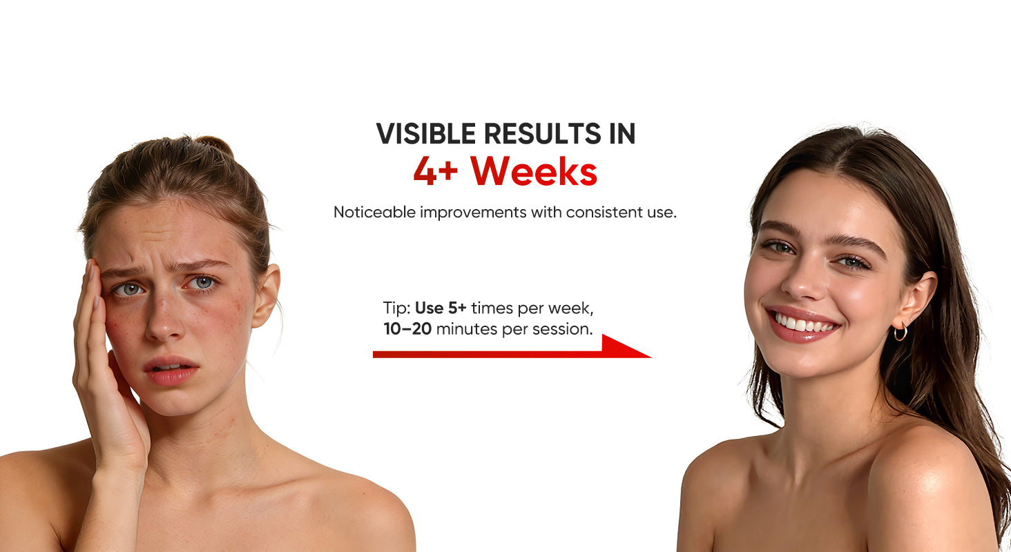 red light therapy facial before and after results on female skin