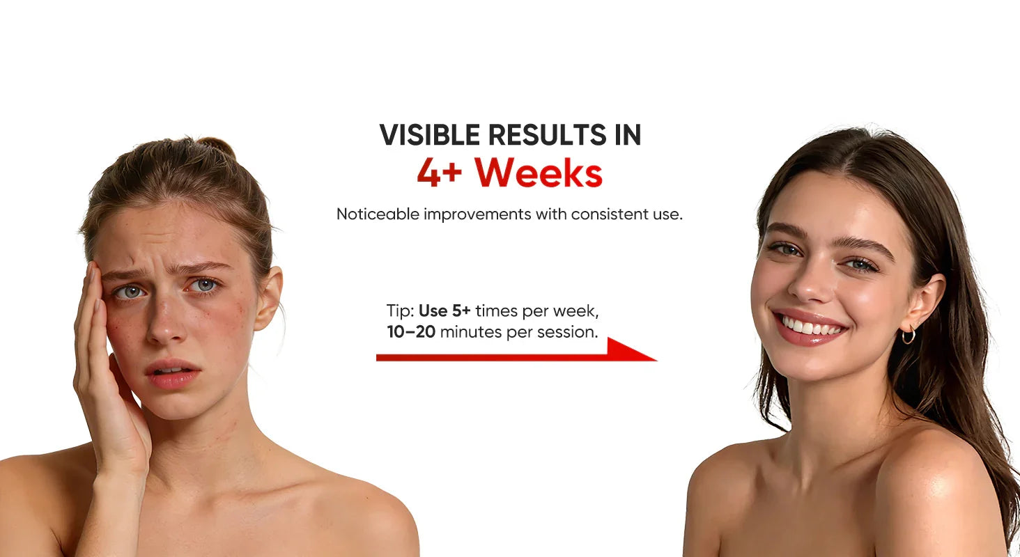 Before and after results for red light therapy showing improved skin health on two women
