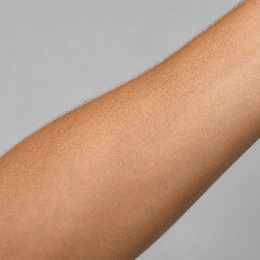 After image showing calmer-looking skin appearance on the arm after a targeted light therapy routine
