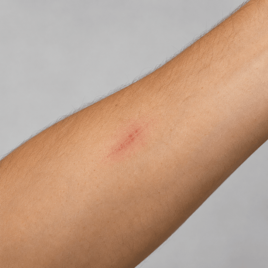 Before image showing a minor skin mark on the arm before a targeted red light therapy routine