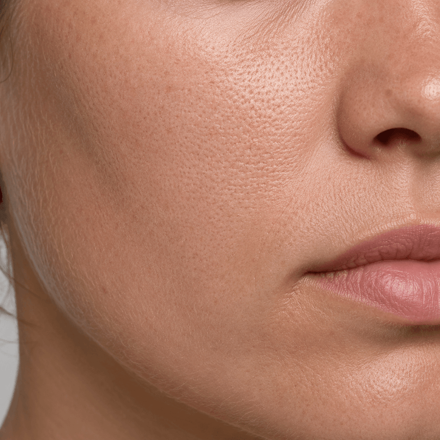 Before image showing facial fine lines and uneven skin texture before a red light therapy routine
