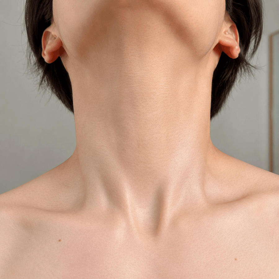 After image showing softer-looking neck lines after a consistent targeted routine